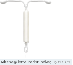 Mirena® intrauterint indlæg