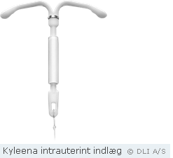 Kyleena intrauterint indlæg