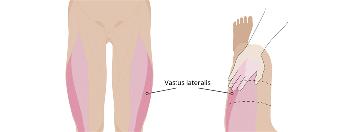 I.m Vastus lateralis 2024