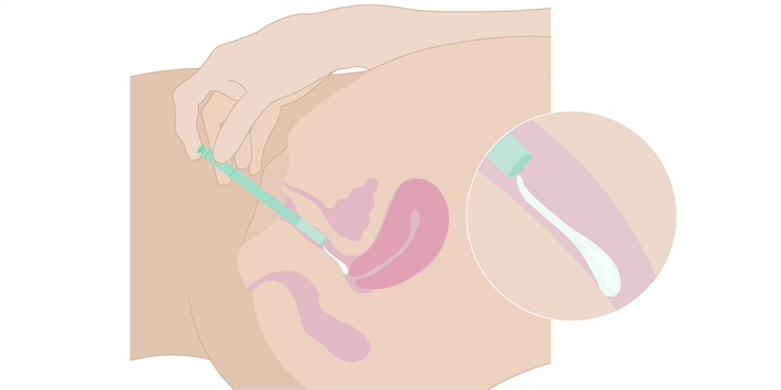 Medicin-som-bruges-i-skeden_applikator-creme-gel_v01_2025.02.14.png